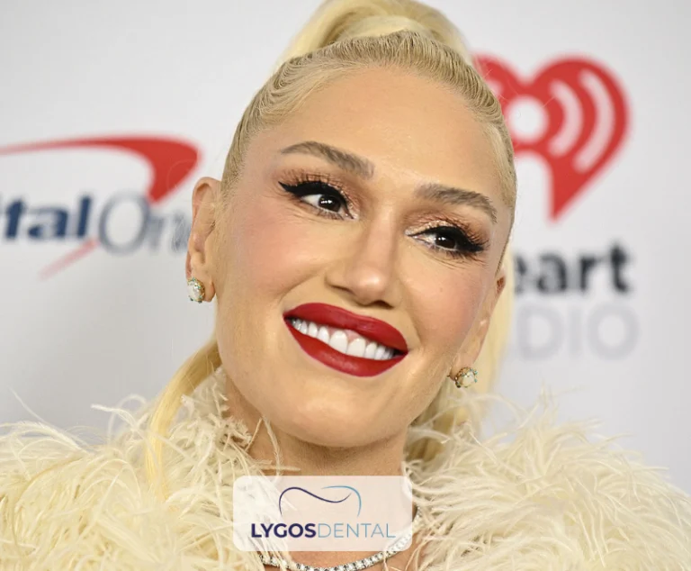 Gwen Stefani Diş Kaplamaları | LYGOS DENTAL