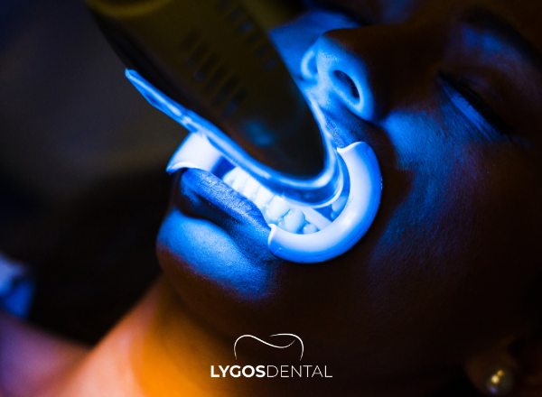 How to Remove Coffee Stains on Teeth | LYGOS DENTAL 2 How to Remove Coffee Stains on Teeth | LYGOS DENTAL