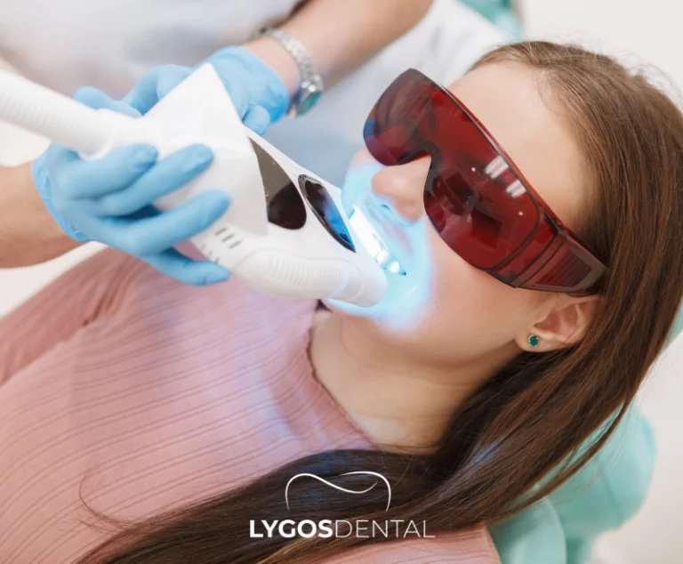 Side Effects of Teeth Whitening Products | LYGOS DENTAL