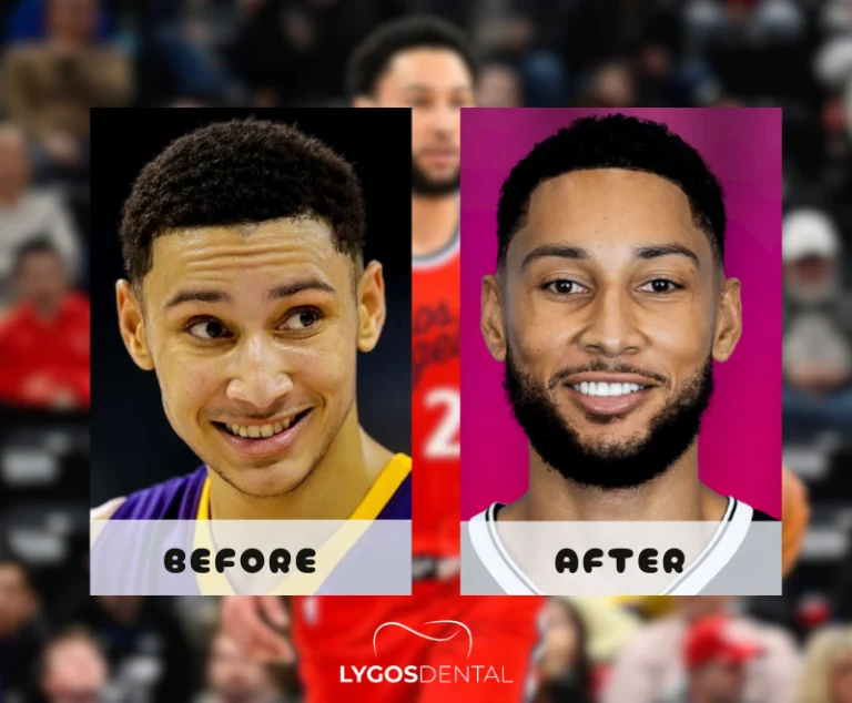 Ben Simmons Dental Aesthetics | LYGOS DENTAL