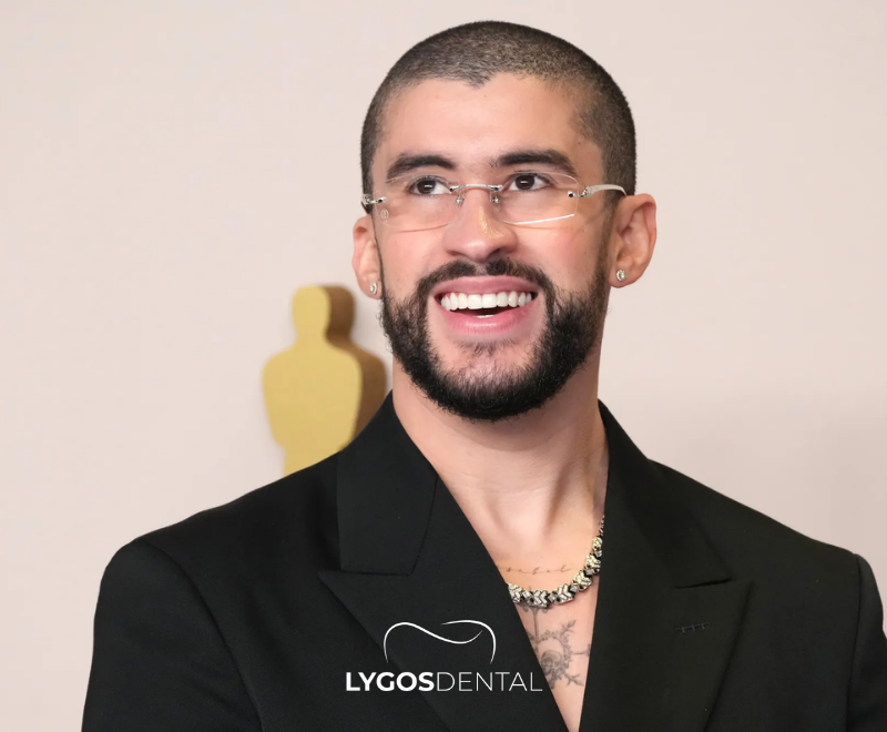 Benito Antonio Esthétique dentaire | LYGOS DENTAL 1 Benito Antonio Esthétique dentaire | LYGOS DENTAL