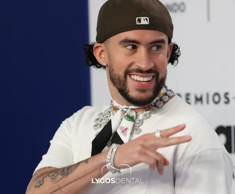 Benito Antonio Esthétique dentaire | LYGOS DENTAL 2 Benito Antonio Esthétique dentaire | LYGOS DENTAL