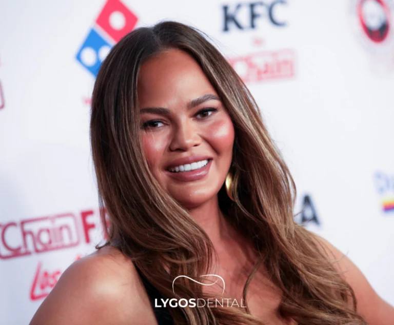 Chrissy Teigen Dental Aesthetics | LYGOS DENTAL 2 Chrissy Teigen Dental Aesthetics | LYGOS DENTAL