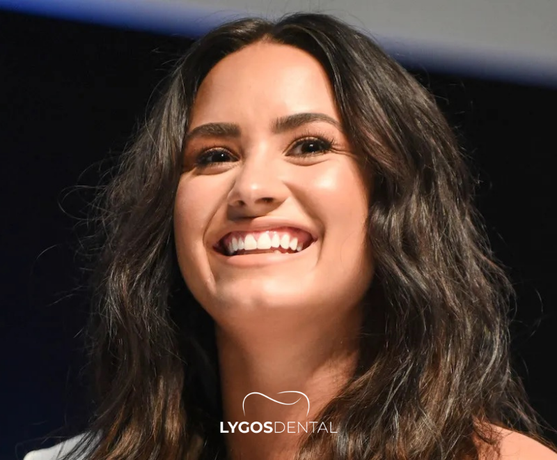 Demi Lovato Dental Aesthetic | LYGOS DENTAL
