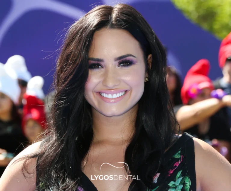 Demi Lovato Dental Aesthetic | LYGOS DENTAL