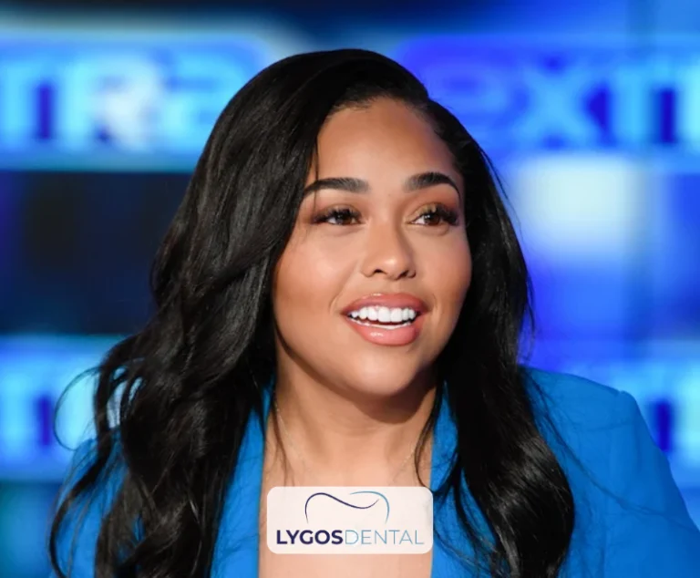 Jordyn Woods Dental Aesthetic