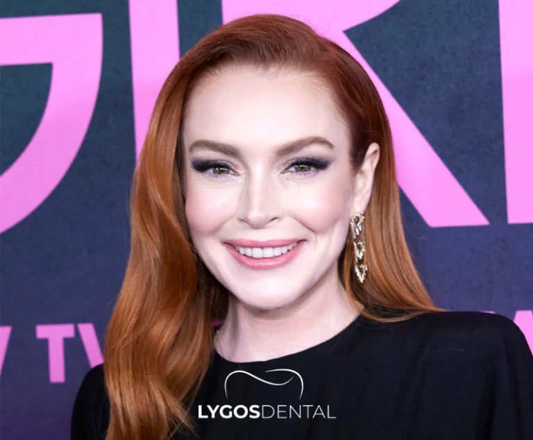 Lindsay Lohan Diş Estetiği | LYGOS DENTAL