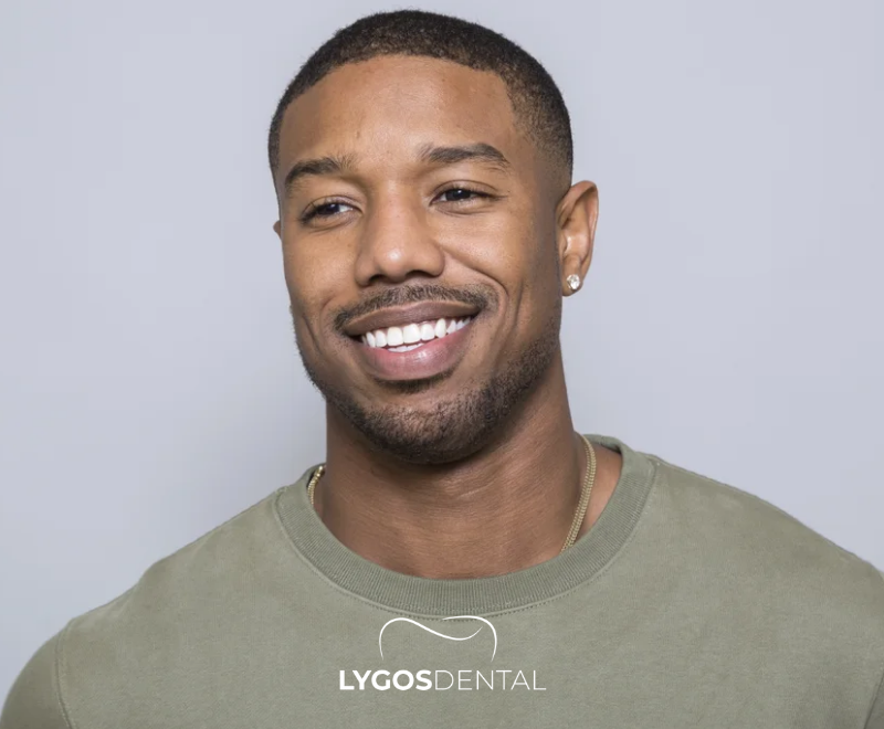 Michael B. Jordan Teeth Veneers 1 Michael B. Jordan Teeth Veneers