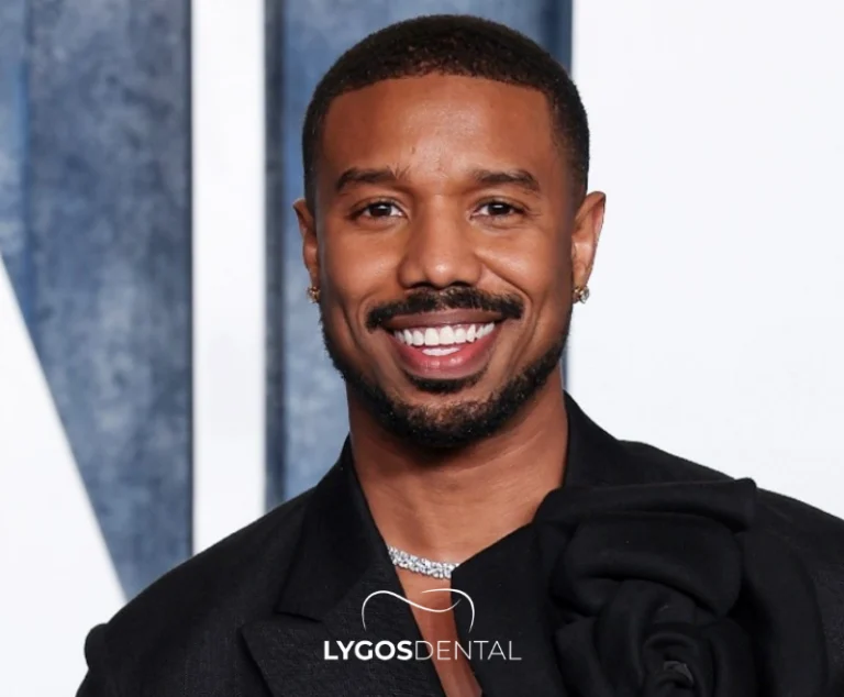 Michael B. Jordan Teeth Veneers 2 Michael B. Jordan Teeth Veneers
