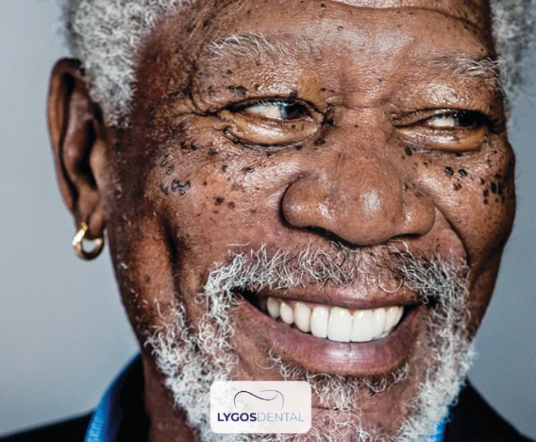 Morgan Freeman Dental Aesthetic