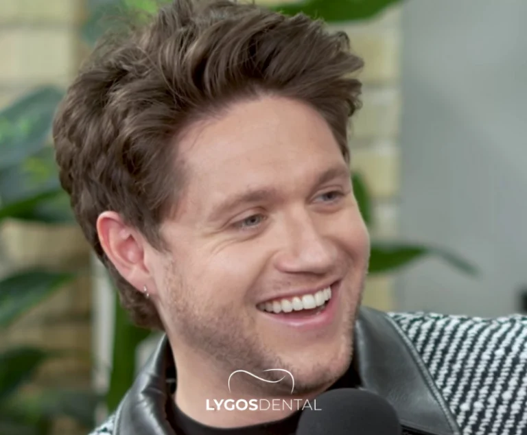 Niall Horan Dental Aesthetics | LYGOS DENTAL