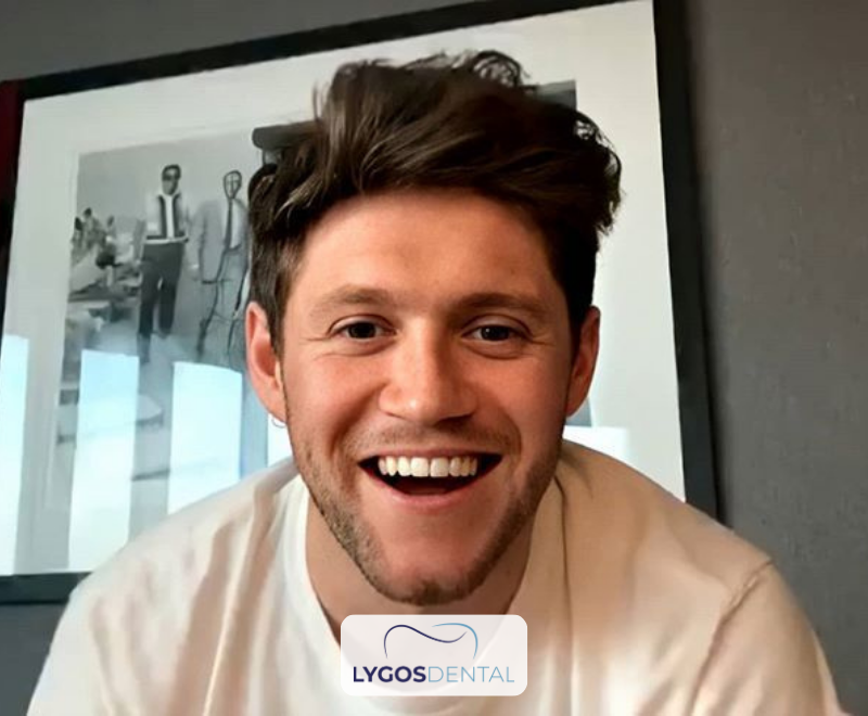 Niall Horan Dental Aesthetics | LYGOS DENTAL