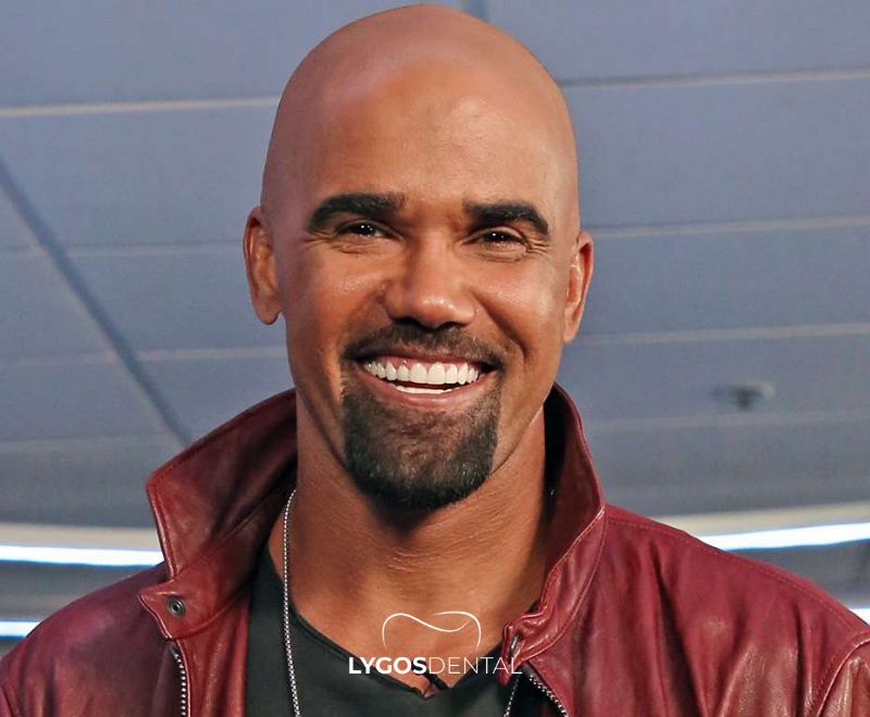 Shemar Moore Teeth Veneers