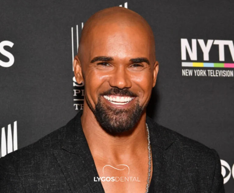 Shemar Moore Teeth Veneers