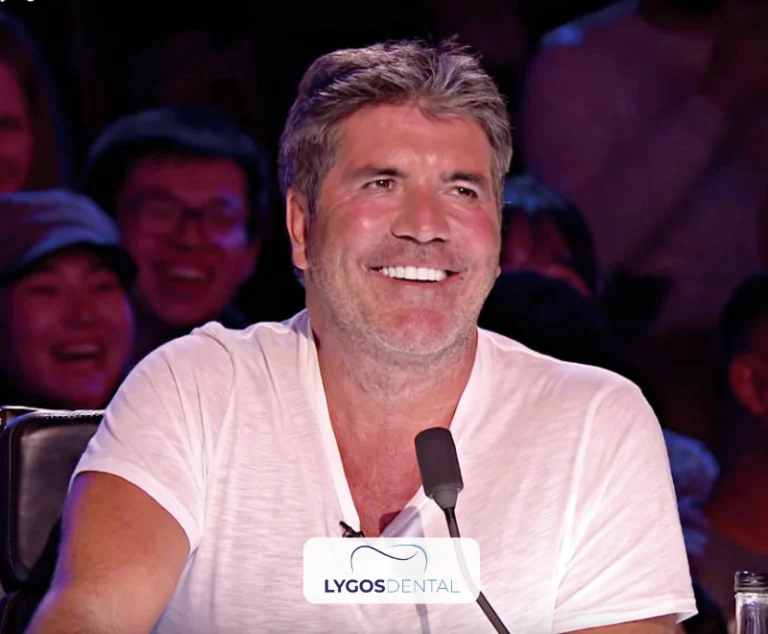 Simon Cowell Zahnästhetik | LYGOS DENTAL 1 Simon Cowell Zahnästhetik | LYGOS DENTAL