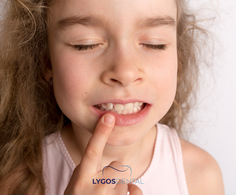 Comment Corriger Des Dents De Travers 1 Quelles Sont les Causes des Dents Croches ?