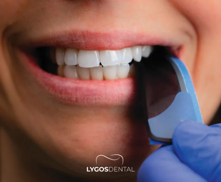 What Causes Pain After a Filling?