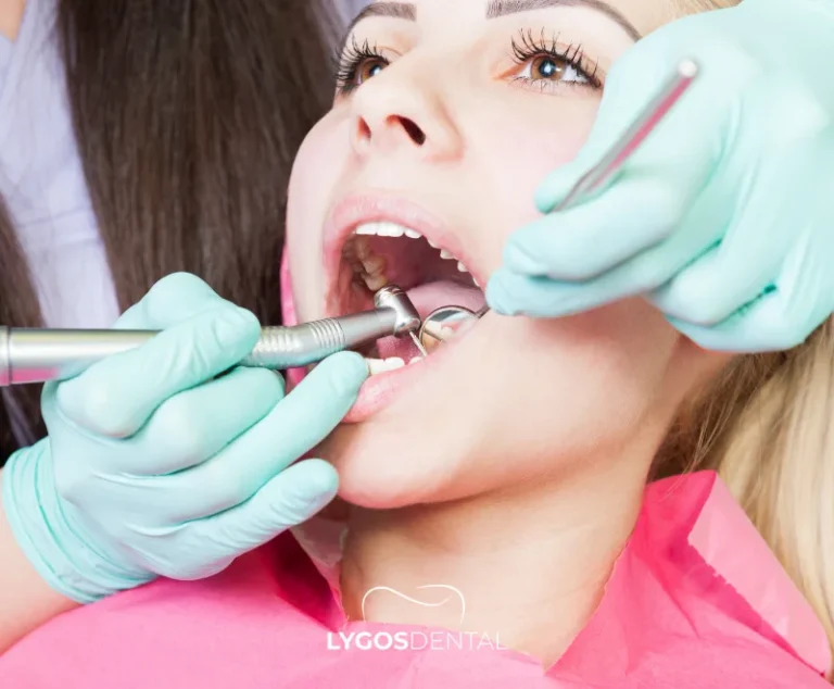 How To Clean Teeth 26 What Is Professional Teeth Cleaning?