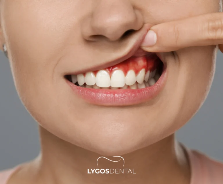 What is Surgical Tooth Extraction 20 When is Surgical Tooth Extraction Necessary?