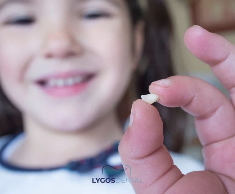 How to Handle a Knocked-Out (Avulsed) Tooth