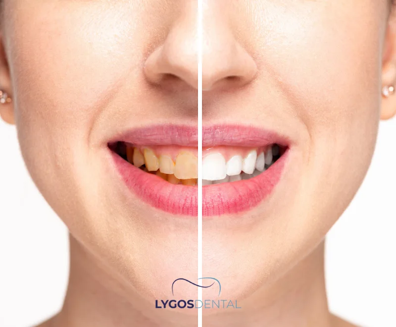 Dental Cleaning Cost Without Insurance 6 The Importance of Regular Dental Cleanings for Oral Health