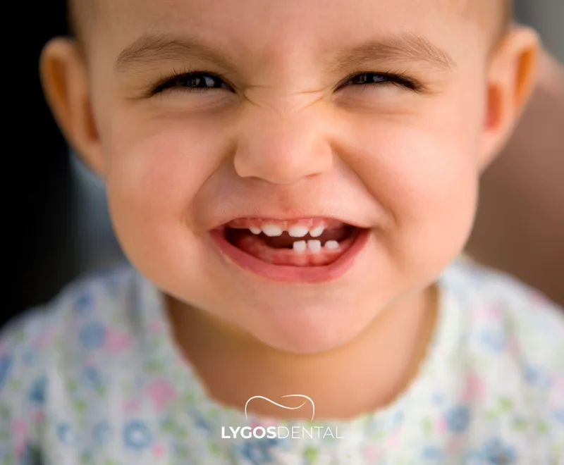 Is It Possible to Treat Baby Teeth? 1 What Are Baby Teeth? When Do They Erupt and Fall Out?