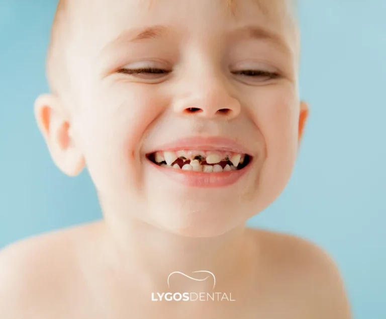 Is It Possible to Treat Baby Teeth? 2 What Are the Symptoms of Baby Tooth Decay?