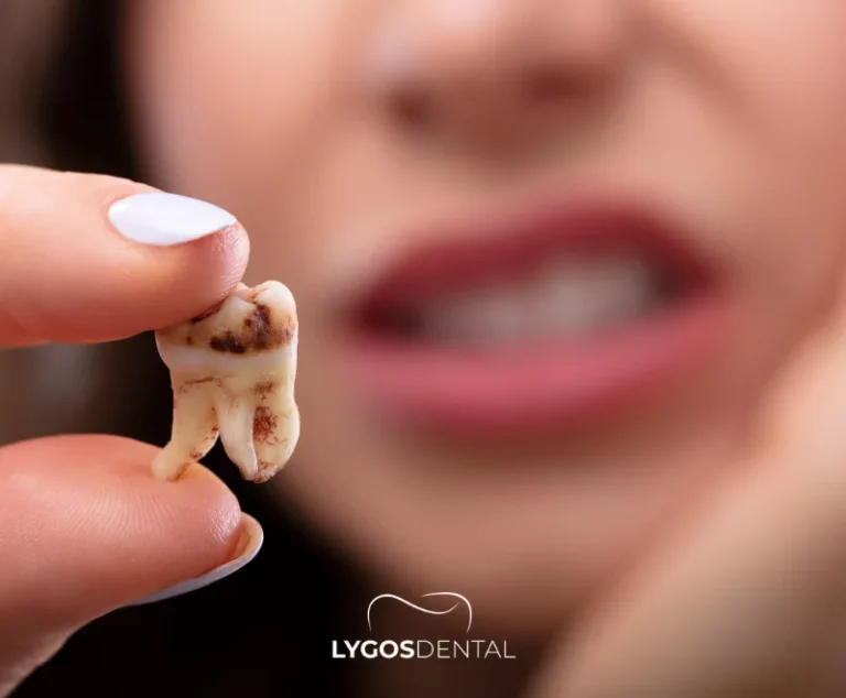 Dentinogenezis İmperfekta'nın Nedenleri