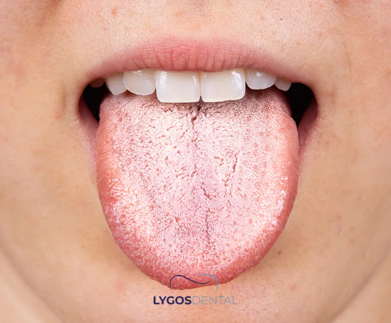 Quand consulter un médecin