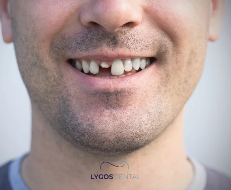 Cosmetic Dentistry Treatments That Can Improve Your Smile 3 Who is Cosmetic Dentistry Suitable For?