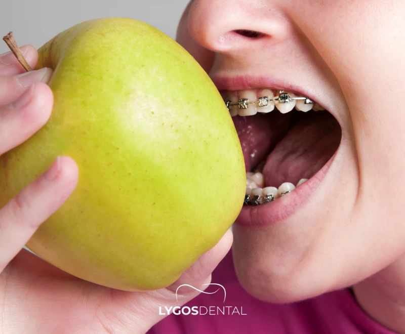 Common Social Challenges for People with Braces