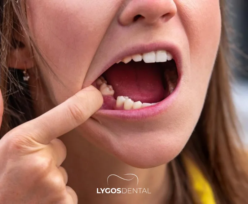 Slows Healing and Leads to Tooth Loss