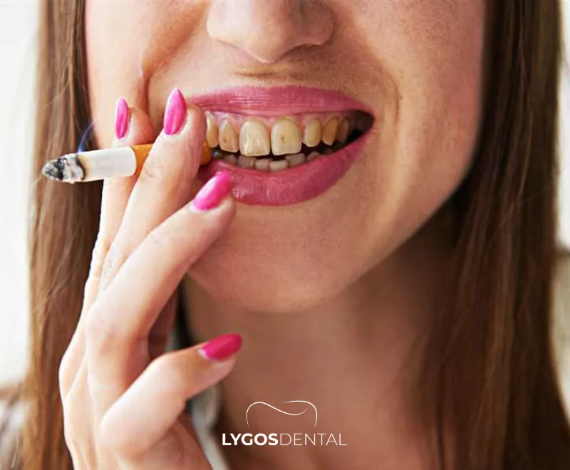 How Does Smoking Harm Teeth?