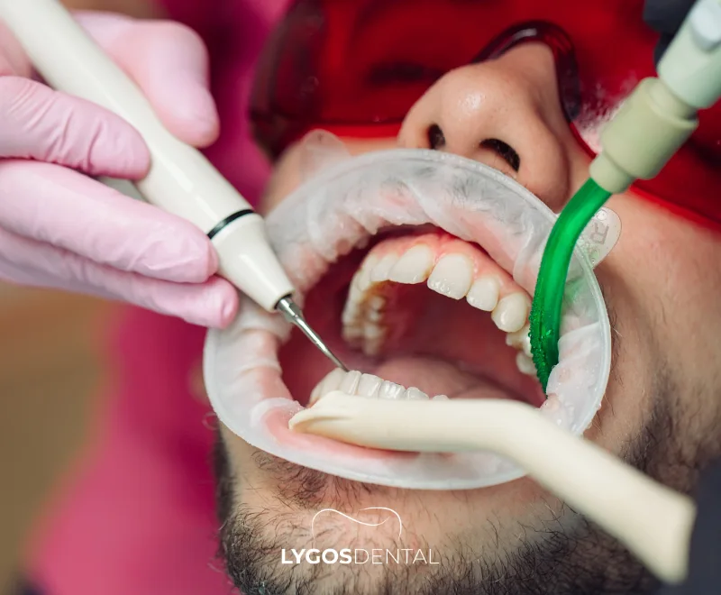 How Do Gum Diseases Affect Heart Health? 3 Why Are Dental Checkups Important in Preventing Heart Diseases?