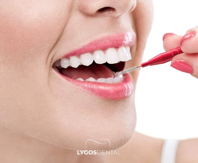 What Is an Interdental Brush and What Does It Do?