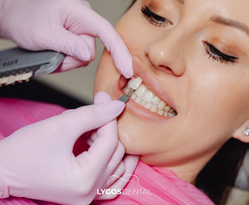 Comment sont traitées les taches dentaires à la tétracycline ?