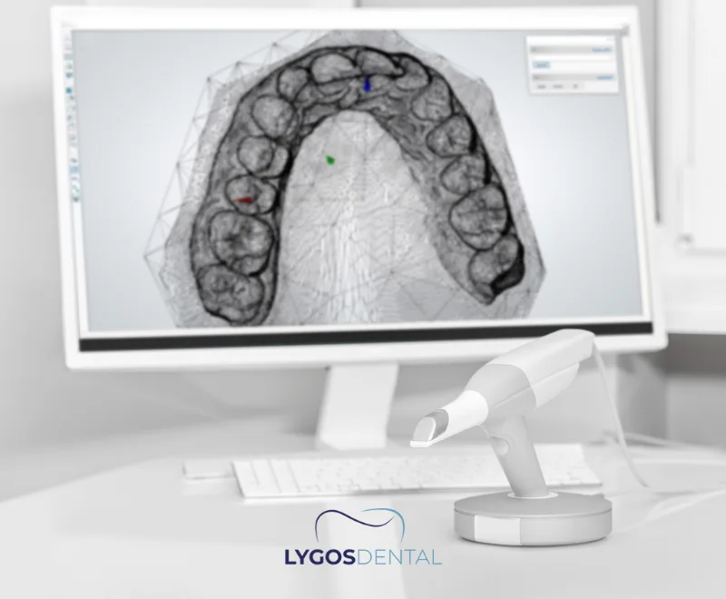 How Are Ectopic Teeth Treated?