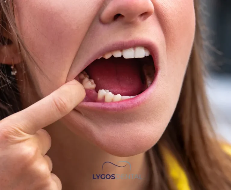 Risks of Apical Resection