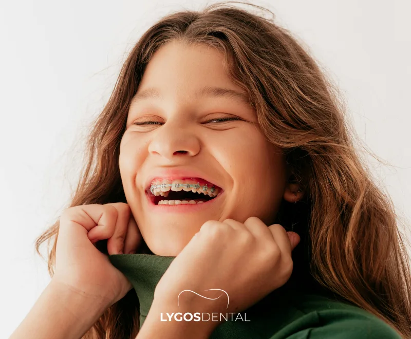 Things You Need to Know Before Getting Braces 1 Who Can Get Braces?