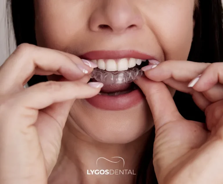 Orthodontics During Adolescence