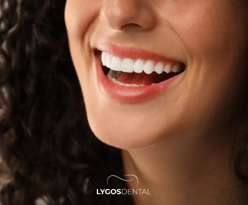 Most Preferred Dental Aesthetic Methods in 2026