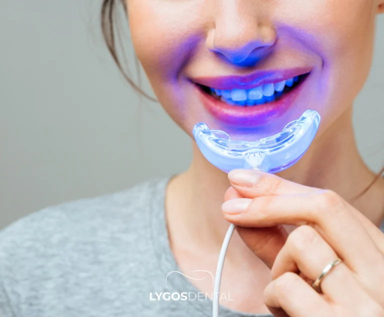 Most Preferred Dental Aesthetic Methods in 2026