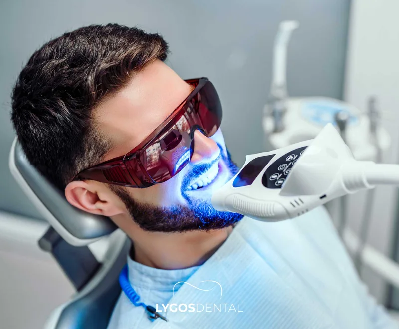 Traitements dentaires esthétiques préférés des célébrités 3 Blanchiment des dents