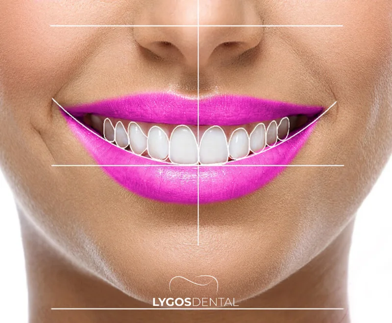 Golden Ratio in Smile Design 1 Golden Ratio in Smile Design