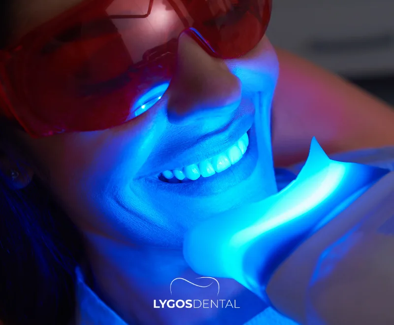 Golden Ratio in Smile Design 3 Golden Ratio in Smile Design