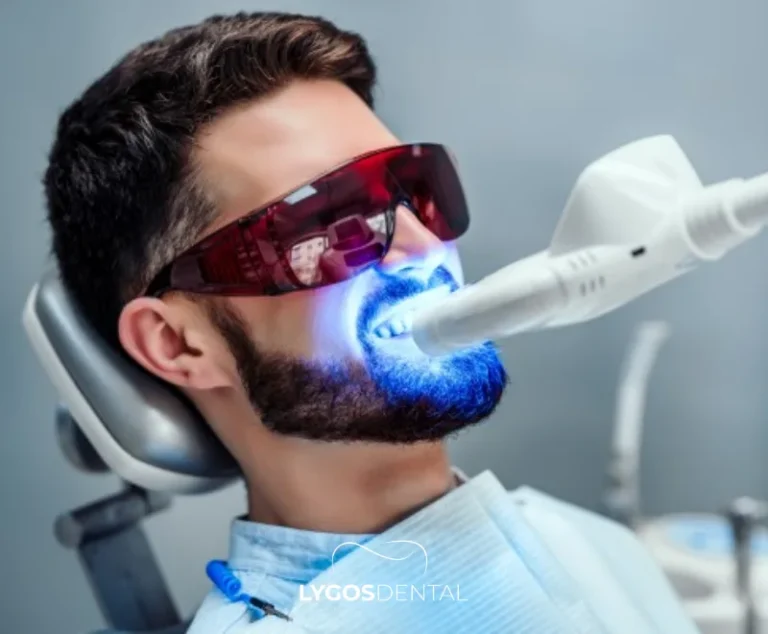 Can Root Canal Treated Teeth Be Whitened? 2 Can Root Canal Treated Teeth Be Whitened?