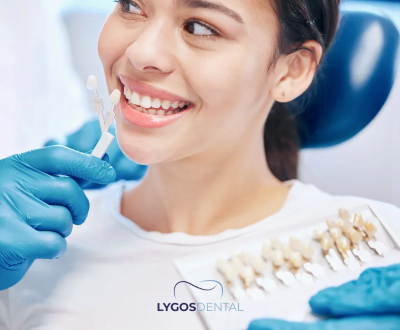 Emax Veneers Durability