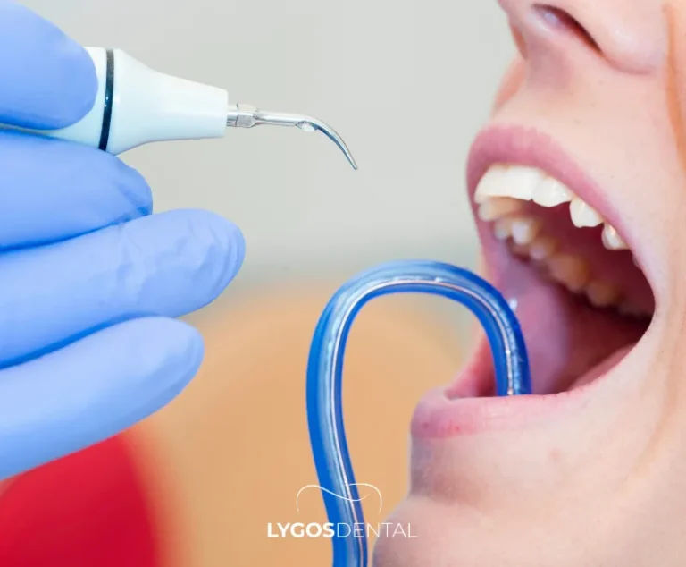 Gum Health Before Laminate Veneers