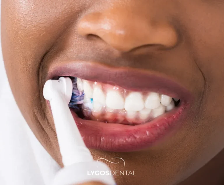 Prevent Sensitivity After Teeth Whitening