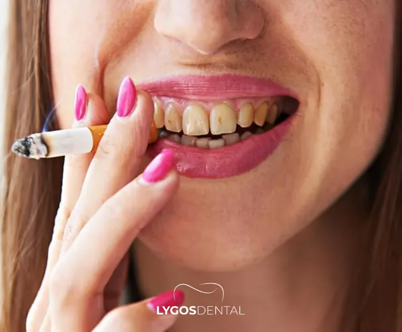 7 facteurs qui nuisent à la santé de vos gencives 1 7 facteurs qui nuisent à la santé de vos gencives